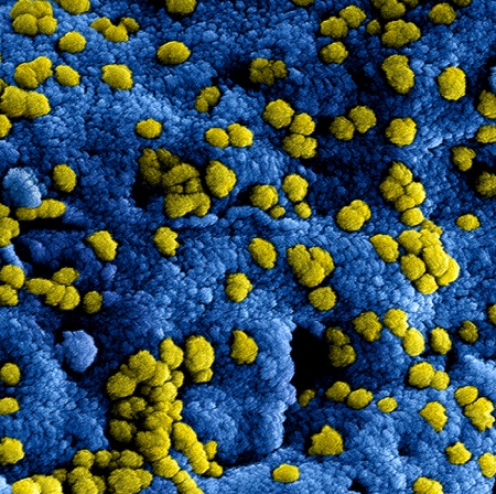 coronavirus